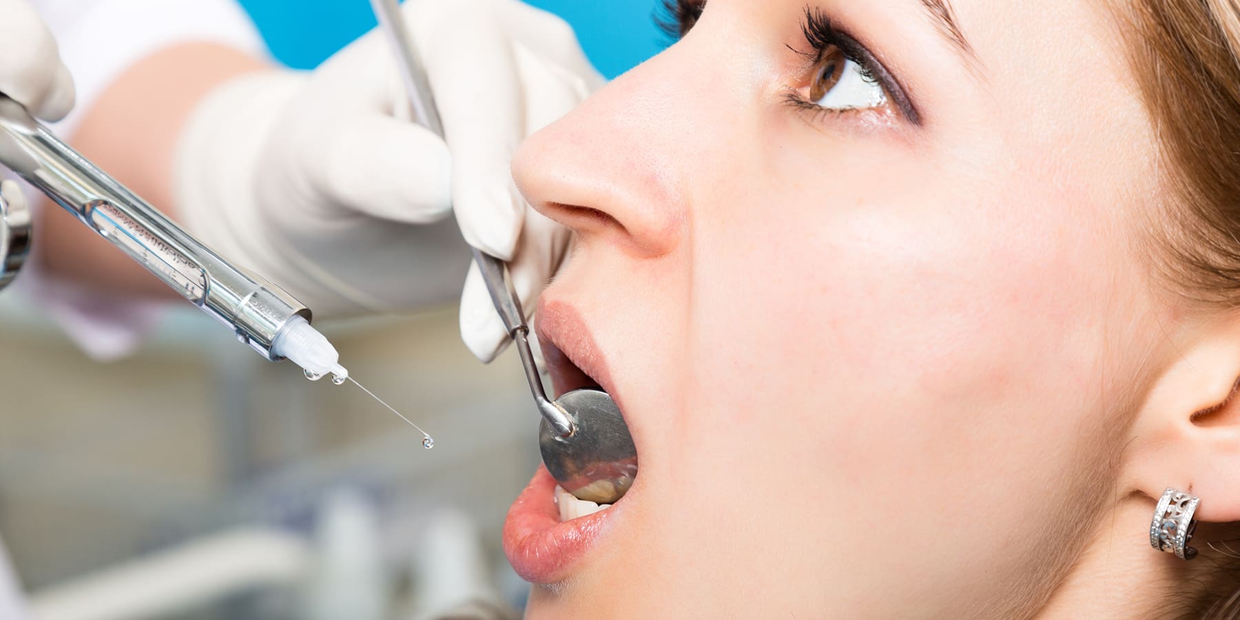 What Is a Calculus Bridge? Causes, Risks, and Treatment Options